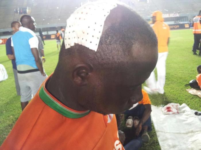 Sénégal - Côte d'Ivoire : Un supporter ivoirien blessé  à la tête