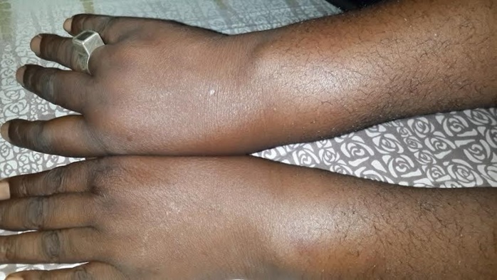 Le chef de station de Rfm-Mbacké torturé par 5 éléments du GMI « L’adjudant Dieng a voulu me briser les doigts et les côtes » accuse-t-il Le chef de station de Rfm-Mbacké torturé par 5 éléments du GMI « L’adjudant Dieng a voulu me briser les doigts et les côtes » accuse-t-il