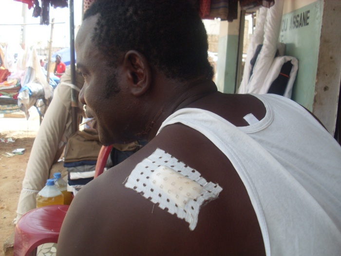 TOUBA- ÉGORGÉ, BABACAR NDIAYE DIT PAPE, ÉCHAPPE A LA MORT : Mon seul tort : « avoir dénoncé un voyou à la police! » TOUBA- ÉGORGÉ, BABACAR NDIAYE DIT PAPE, ÉCHAPPE A LA MORT : Mon seul tort : « avoir dénoncé un voyou à la police! »