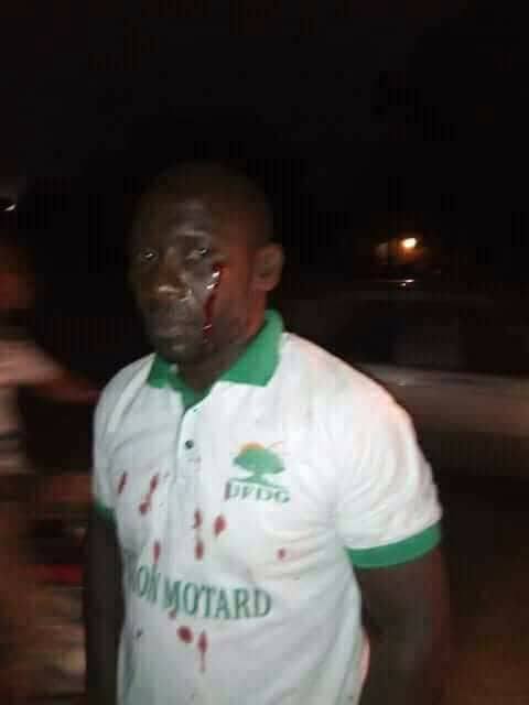 Heurts entre militants de Cellou Dalein et forces de l’ordre : Conakry à feu et à sang ce mercredi (images choquantes) Heurts entre militants de Cellou Dalein et forces de l’ordre : Conakry à feu et à sang ce mercredi (images choquantes)