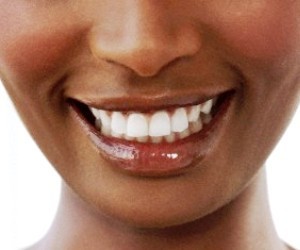 Le détartrage des dents réduit le risque de crise cardiaque