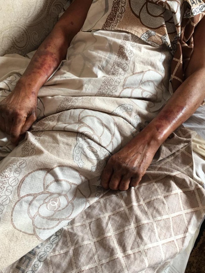 Cite Mixta : Une femme suicidaire qui tente de sauter du haut d’un immeuble se fait violenter par des ASP et menace de porter plainte Cite Mixta : Une femme suicidaire qui tente de sauter du haut d’un immeuble se fait violenter par des ASP et menace de porter plainte