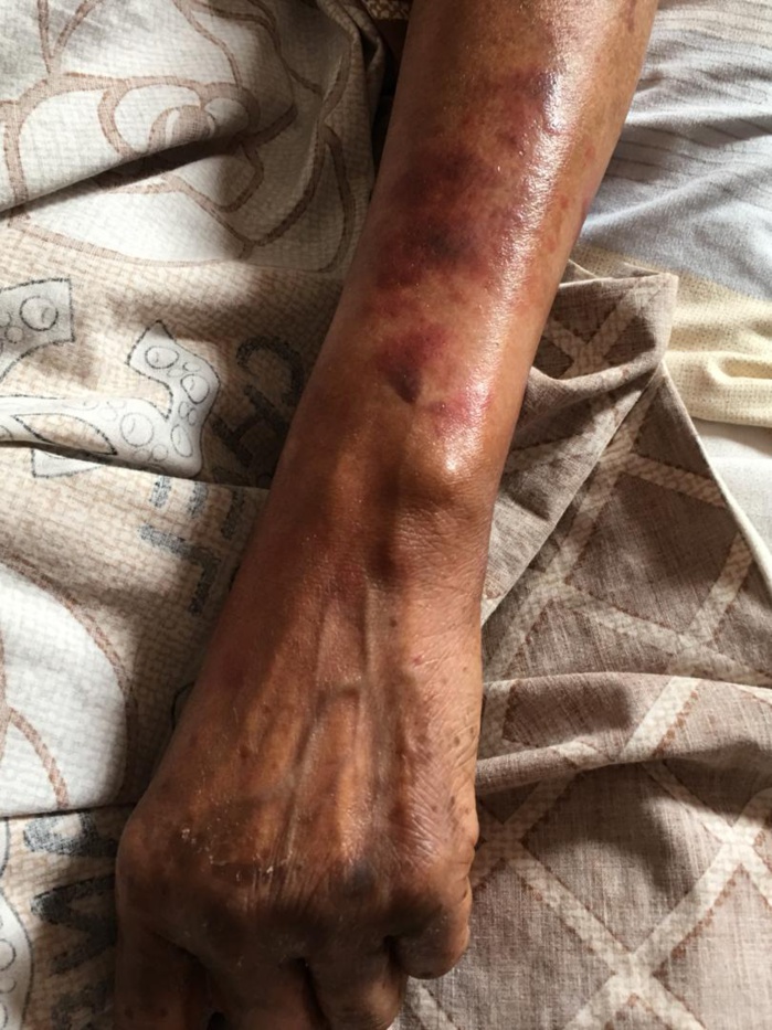 Cite Mixta : Une femme suicidaire qui tente de sauter du haut d’un immeuble se fait violenter par des ASP et menace de porter plainte Cite Mixta : Une femme suicidaire qui tente de sauter du haut d’un immeuble se fait violenter par des ASP et menace de porter plainte