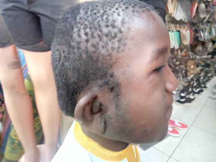 SOS : L’appel à l’aide de Serigne Fallou Gueye atteint d’une maladie grave et très couteuse