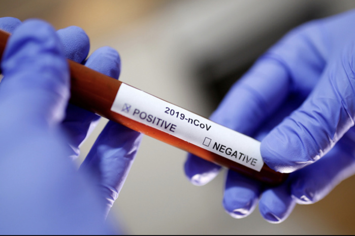 Exclusif Dakaractu : Un peu plus sur le second cas confirmé de Coronavirus au Sénégal.