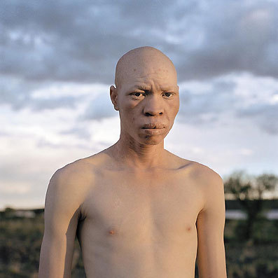 Accusation d’assassinat d’un albinos: "C'est gênant pour un ancien président d’en arriver là" (Samba Ndiaye)