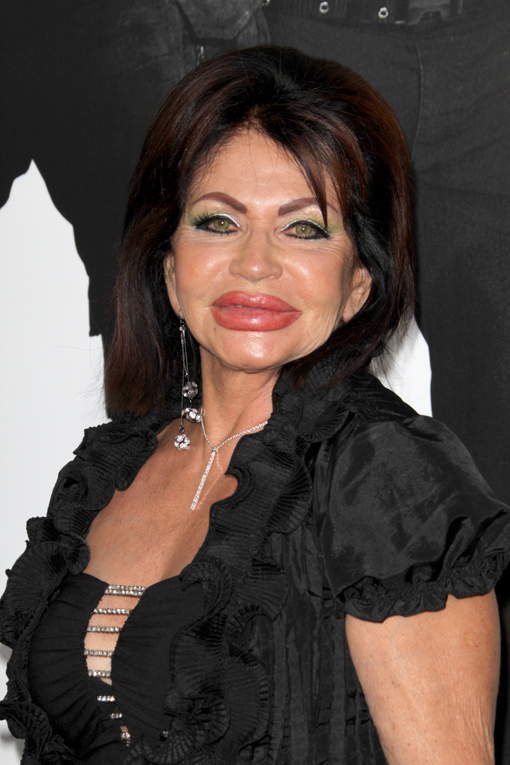 La mère de Stallone (horrible) reine du Botox (photos)