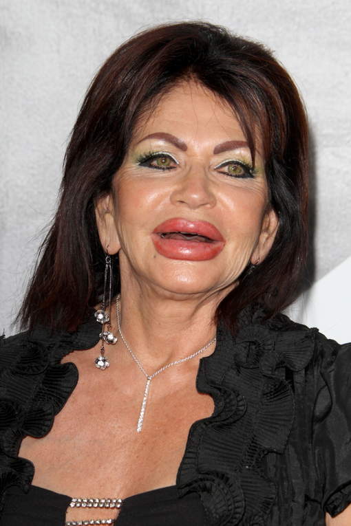 La mère de Stallone (horrible) reine du Botox (photos)