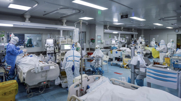 Coronavirus : Le hoquet et la perte de cheveux, des signes nouveaux. Coronavirus : Le hoquet et la perte de cheveux, des signes nouveaux.