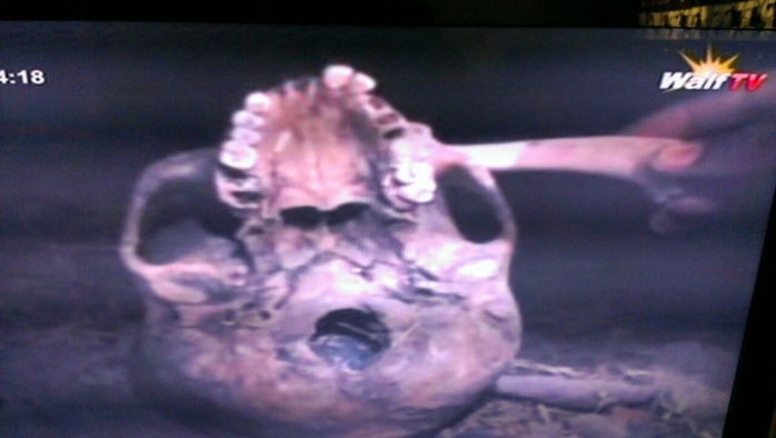 Voici le crâne d'homme trouvé au quartier Léona de Rufisque