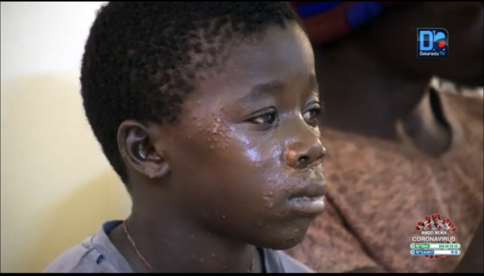 Retour sur la maladie mystérieuse : Les autorités sanitaires lancent une 'recherche active' des patients affectés à domicile et en mer.