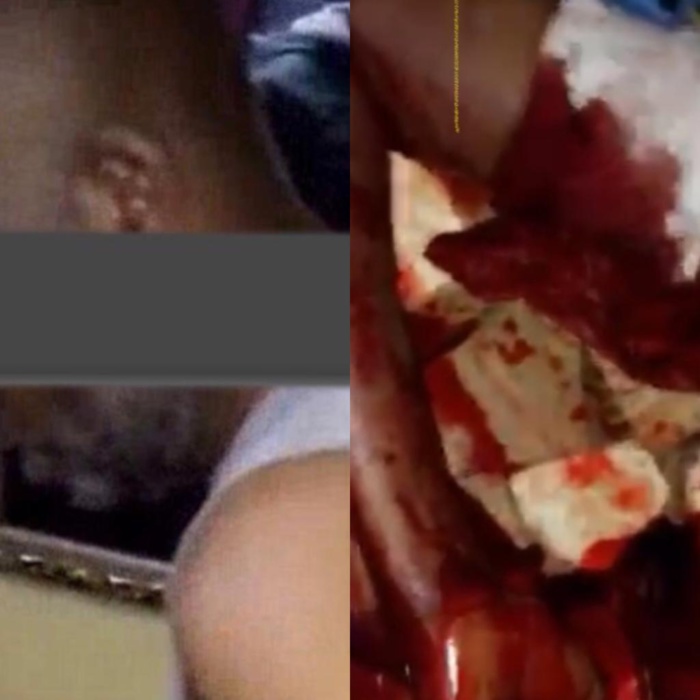 Cité millionnaire de Grand-Yoff : une femme poignardée par son mari Cité millionnaire de Grand-Yoff : une femme poignardée par son mari