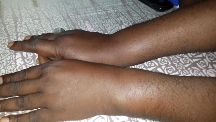 Le chef de station de Rfm-Mbacké torturé par 5 éléments du GMI « L’adjudant Dieng a voulu me briser les doigts et les côtes » accuse-t-il