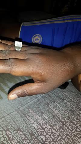 Le chef de station de Rfm-Mbacké torturé par 5 éléments du GMI « L’adjudant Dieng a voulu me briser les doigts et les côtes » accuse-t-il