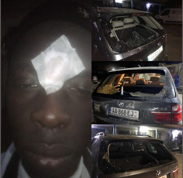 ÉNORME VIOLENCE À DIOURBEL / Heurts entre partisans du ministre Dame Diop et ceux de Malick Fall … blessés et dégâts matériels inestimables ! ÉNORME VIOLENCE À DIOURBEL / Heurts entre partisans du ministre Dame Diop et ceux de Malick Fall … blessés et dégâts matériels inestimables !