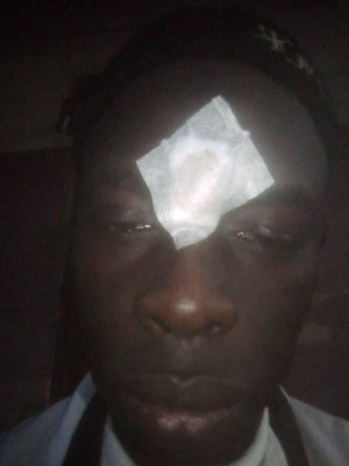 ÉNORME VIOLENCE À DIOURBEL / Heurts entre partisans du ministre Dame Diop et ceux de Malick Fall … blessés et dégâts matériels inestimables !