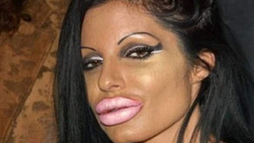 La chirurgie (in)esthétique des célébrités