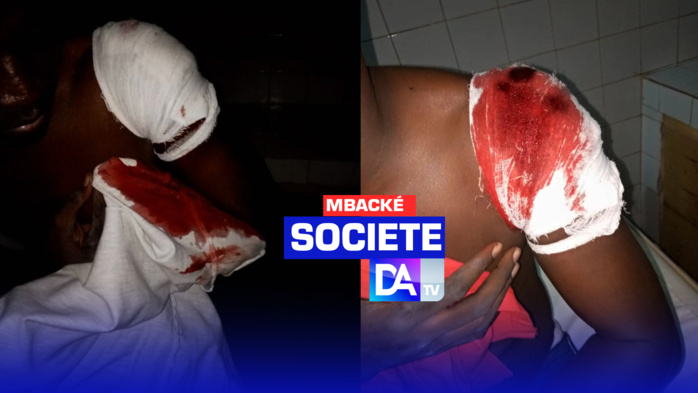 MBACKÉ - Un enseignant sauvagement agressé ! Bouba qui a perdu beaucoup de son sang, a aussi failli perdre son épaule
