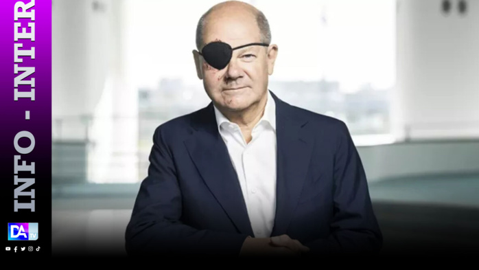 Olaf le pirate: le chancelier allemand se présente avec un cache-oeil après sa chute Olaf le pirate: le chancelier allemand se présente avec un cache-oeil après sa chute