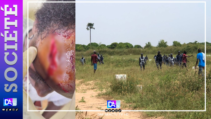 Litige foncier à Mbeye/violents affrontements en FDS et populations: des arrestations et des blessés graves, la mairie de Bambilor saccagée Litige foncier à Mbeye/violents affrontements en FDS et populations: des arrestations et des blessés graves, la mairie de Bambilor saccagée