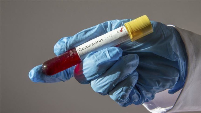 Coronavirus : les contaminations ont augmenté de 52 % en un mois dans le monde, touchant aussi le Sénégal Coronavirus : les contaminations ont augmenté de 52 % en un mois dans le monde, touchant aussi le Sénégal