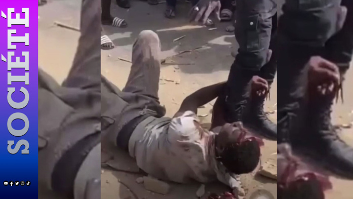 TOUBA- Un adulte lynché pour avoir été surpris en train d’égorger un enfant … L’enfant entre la vie et la mort TOUBA- Un adulte lynché pour avoir été surpris en train d’égorger un enfant … L’enfant entre la vie et la mort