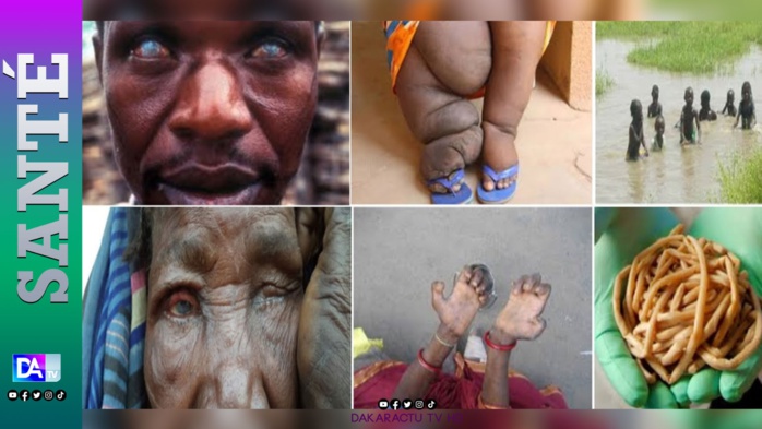 Santé publique : L’État vers l'élimination totale des maladies tropcales négligées d'ici à 2030 Santé publique : L’État vers l'élimination totale des maladies tropcales négligées d'ici à 2030