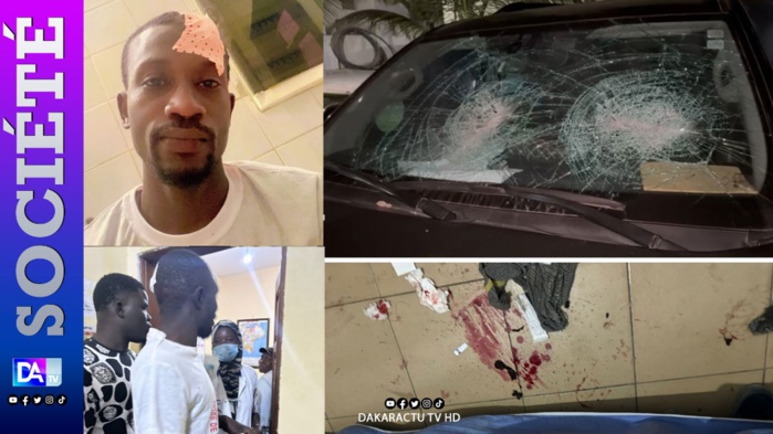 Violence électorale à Pikine : Des heurts entre Pro Diomaye et Pro Amadou Bâ font plusieurs blessés Violence électorale à Pikine : Des heurts entre Pro Diomaye et Pro Amadou Bâ font plusieurs blessés