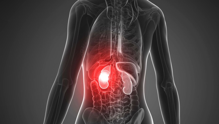 Insuffisance rénale : Ziguinchor enregistre plus de 500 cas par an Insuffisance rénale : Ziguinchor enregistre plus de 500 cas par an