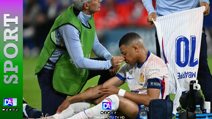 Euro-2024: Kylian Mbappé a le nez cassé Euro-2024: Kylian Mbappé a le nez cassé