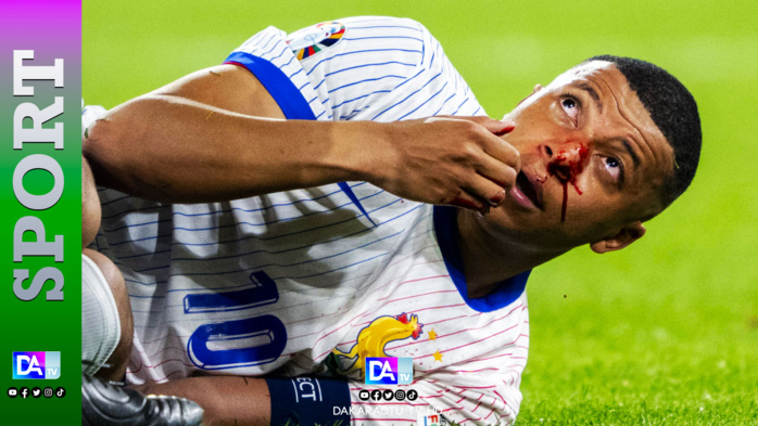 Euro-2024: Kylian Mbappé, un retour sous conditions Euro-2024: Kylian Mbappé, un retour sous conditions