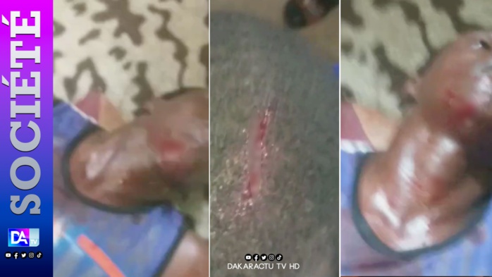 Mutinerie au Camp pénal de Liberté 6 :  Des détenus blessés  par balles à blanc...