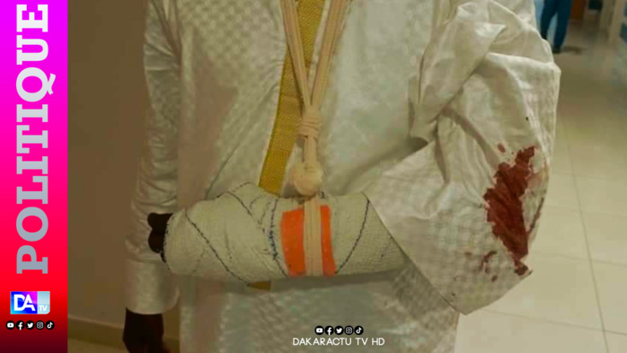Accrochage à Koungheul : le Grand Parti liste Gackou parmi les blessés, parle de tentative d’assassinat et annonce une plainte. Accrochage à Koungheul : le Grand Parti liste Gackou parmi les blessés, parle de tentative d’assassinat et annonce une plainte.