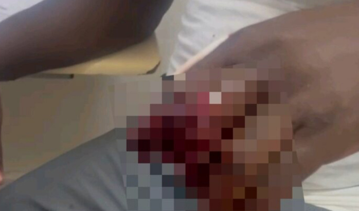 MBACKÉ – Pour avoir annoncé la disponibilité d’un financement de 100 millions, le président des mareyeurs reçoit des coups de feu à la main MBACKÉ – Pour avoir annoncé la disponibilité d’un financement de 100 millions, le président des mareyeurs reçoit des coups de feu à la main