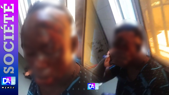 MBACKÉ – Affaire de la femme ébouillantée à l’acide / La présumée coupable livrée à la gendarmerie par l’époux de la victime, par ailleurs son frère MBACKÉ – Affaire de la femme ébouillantée à l’acide / La présumée coupable livrée à la gendarmerie par l’époux de la victime, par ailleurs son frère