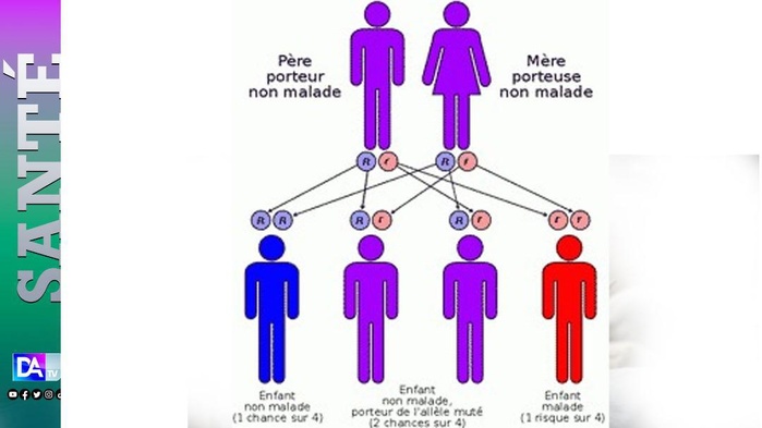 19 juin – Journée mondiale de lutte contre la drépanocytose 19 juin – Journée mondiale de lutte contre la drépanocytose