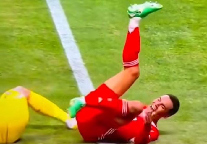 MUSIALA / Fracture du péroné et lésions ligamentaires après un choc avec Donnarumma MUSIALA / Fracture du péroné et lésions ligamentaires après un choc avec Donnarumma