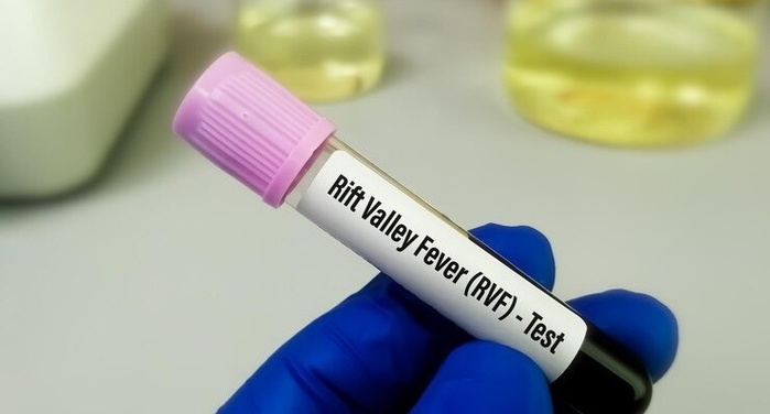 Fièvre de la vallée du Rift et MPOX : 5 nouveaux cas de la fièvre du Rift enregistrés Fièvre de la vallée du Rift et MPOX : 5 nouveaux cas de la fièvre du Rift enregistrés