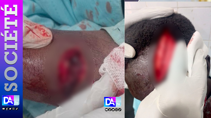 TOUBA – Un berger blesse grièvement avec une machette un maître coranique et prend la fuite. TOUBA – Un berger blesse grièvement avec une machette un maître coranique et prend la fuite.