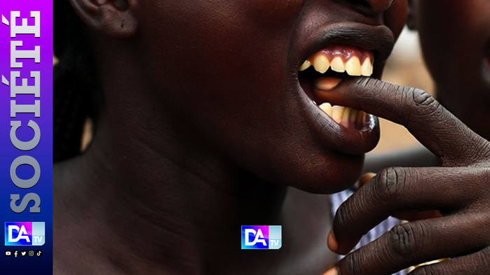Mbour : Pour 5 000 FCFA d’électricité Woyofal, elle arrache le doigt de sa colocataire avec les dents Mbour : Pour 5 000 FCFA d’électricité Woyofal, elle arrache le doigt de sa colocataire avec les dents