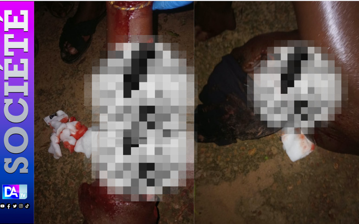 Gassane : un couple attaqué à coups de machette lors d’une tentative de vol, deux doigts sectionnés Gassane : un couple attaqué à coups de machette lors d’une tentative de vol, deux doigts sectionnés