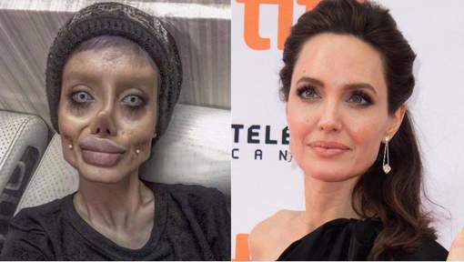 Plus de 50 opérations pour ressembler à Angelina Jolie : un gros mensonge