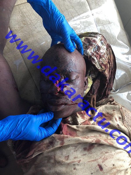 Violence post-électorale en Guinée Conakry : le jeune Mamadou Bailo Diallo mortellement touché par un gendarme (images choquantes)