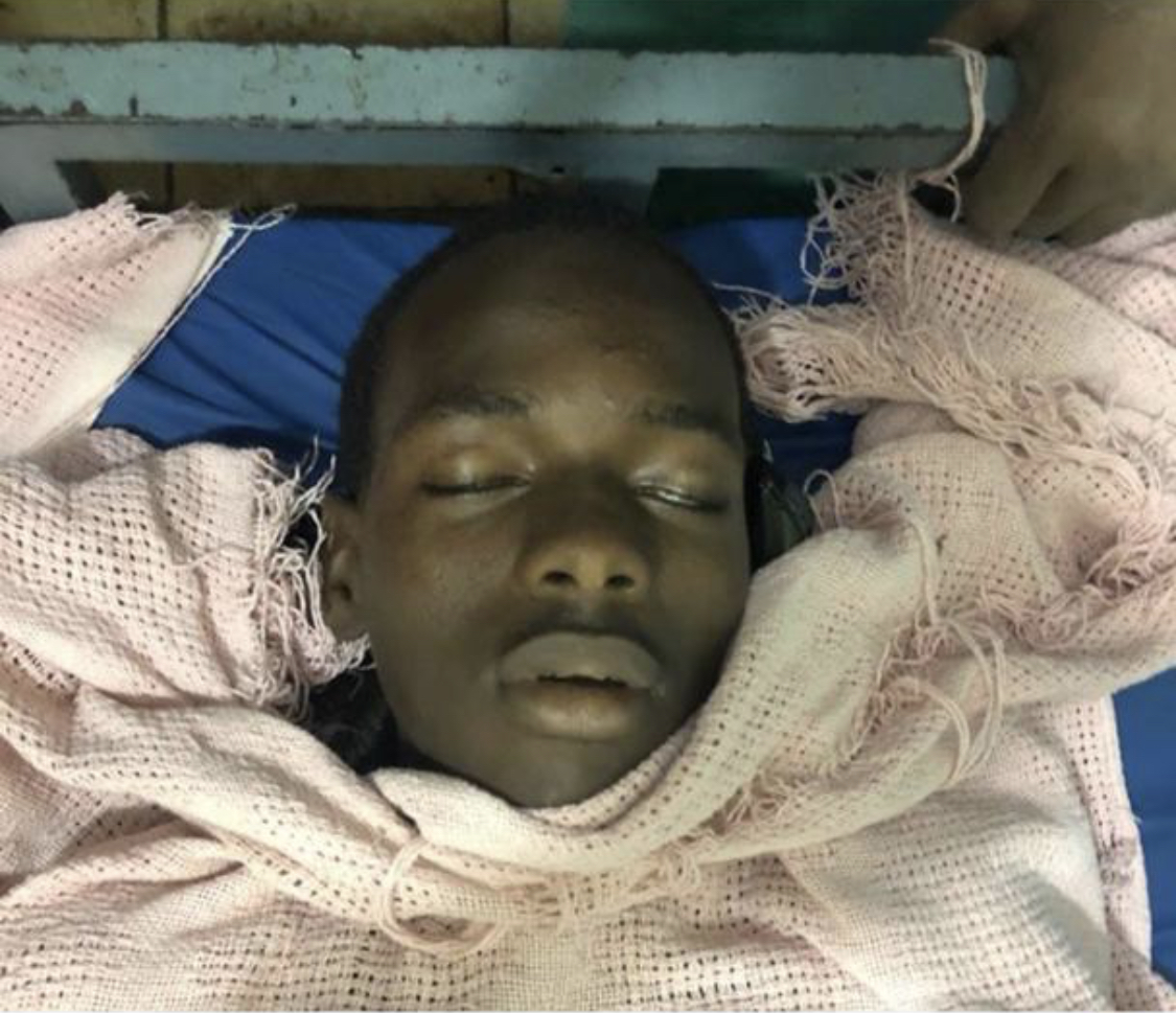 Marche de l’opposition en Guinée : Un manifestant de 18 ans tué