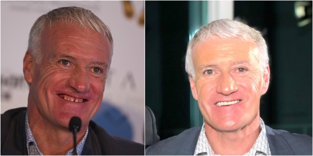 Didier Deschamps S est Fait Une Nouvelle Dentition Transformation didier-deschamps-s-est-fait-une-nouvelle-dentition-transformation