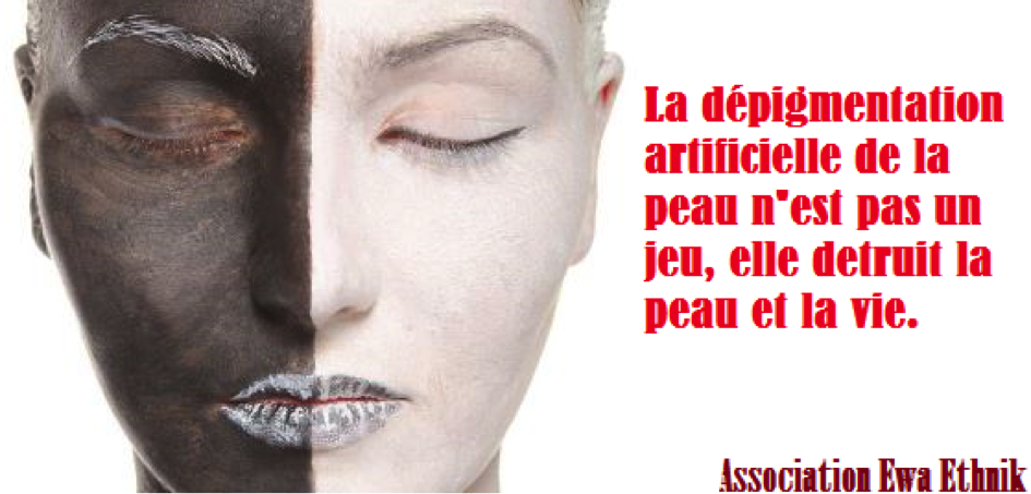 Lutte contre la dépigmentation artificielle : Qui pour être Kagamé ? (Par le Pr Fatimata Ly)