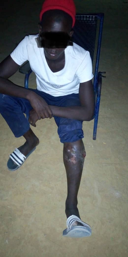 SOS / Atteint d’ulcère veineux : M.S risque l'amputation de sa jambe.