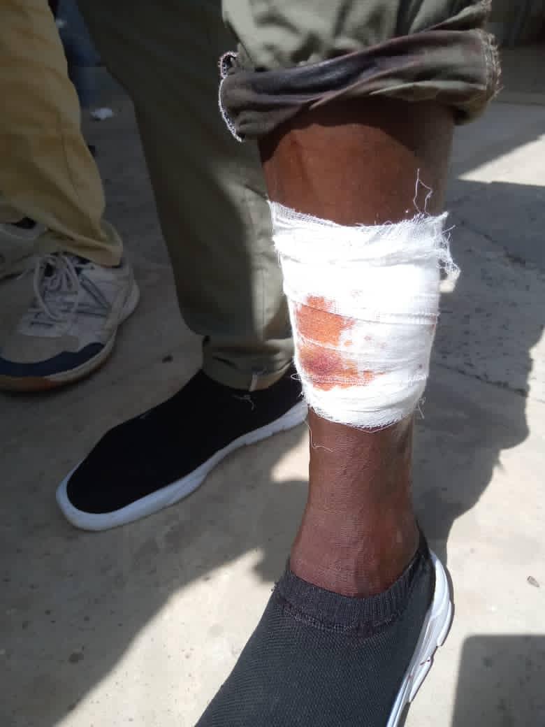 Ucad : Un étudiant blessé par balle au pied lors des affrontements.