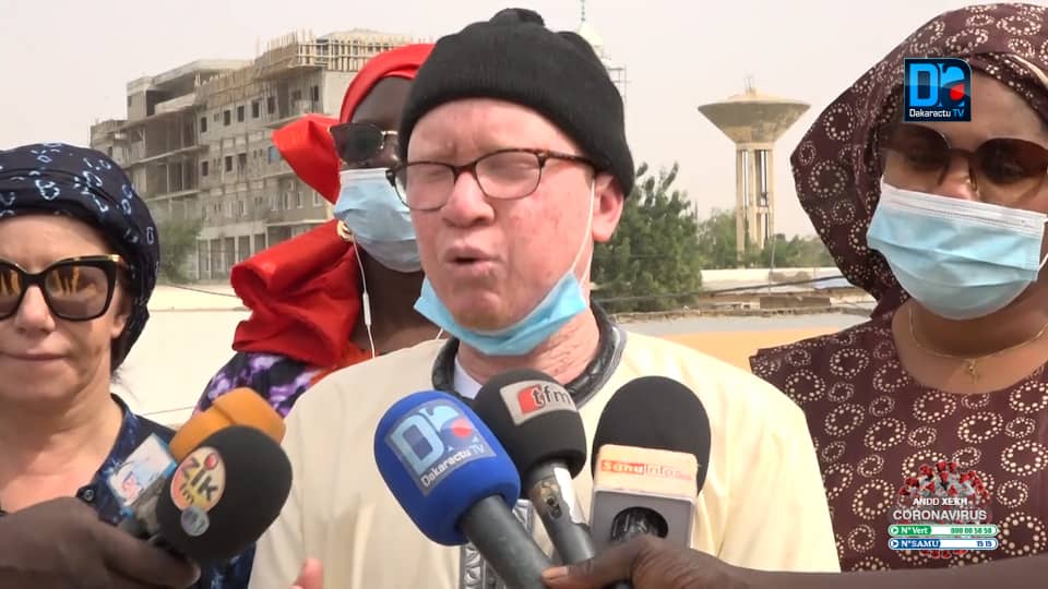 TOUBA / « Depuis longtemps, nous n'avons pas reçu de crème solaire venant de l'État du Sénégal » (ALBINOS).