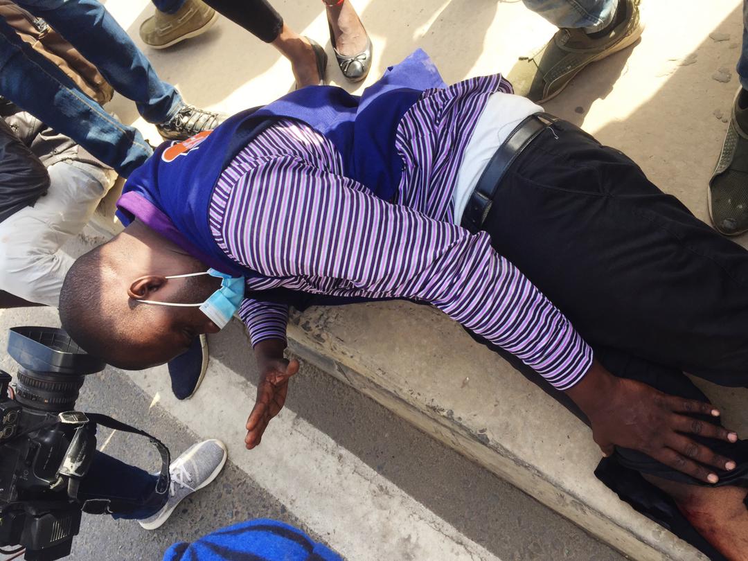 Rond-point Mermoz : Un reporter reçoit une balle à blanc à la jambe